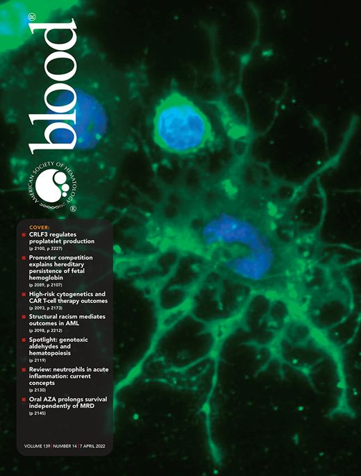 Single-cell multiomics reveals increased plasticity, resistant populations, and stem-cell like blasts in i KMT2A i -rearranged leukemia